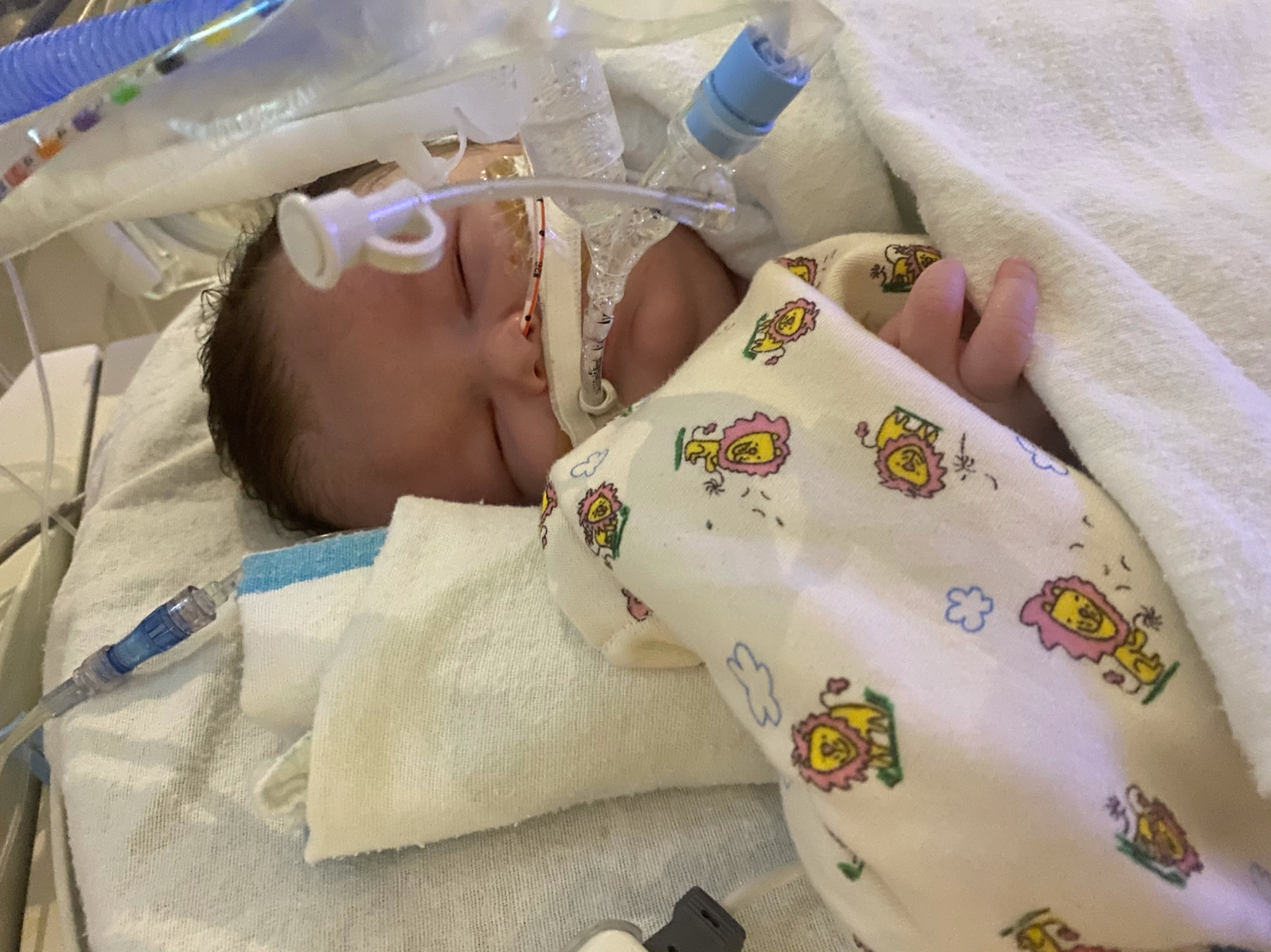 Baby JP in NICU