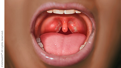 illustration illustration