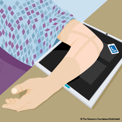 elbow_xray_illustration elbow_xray_illustration