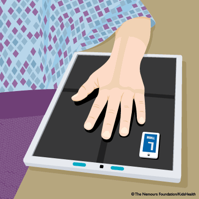hand_xray_illustration hand_xray_illustration