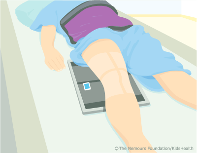 knee xray illustration knee xray illustration