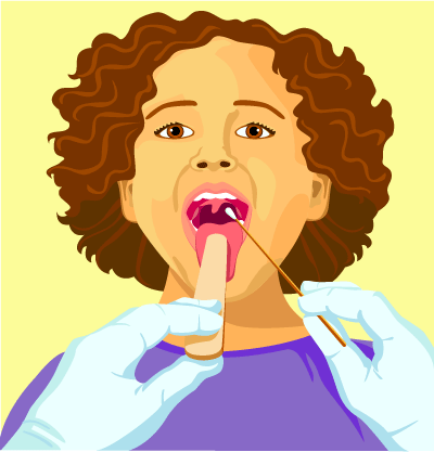 throat_swab_illustration throat_swab_illustration