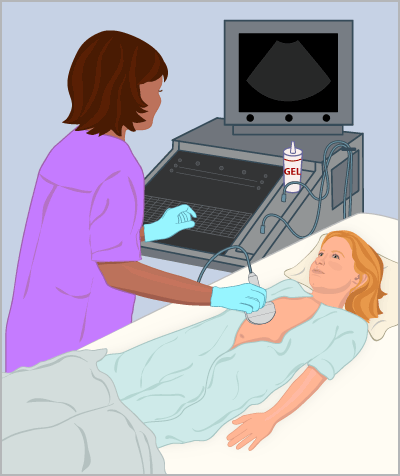 ultrasound_illustration ultrasound_illustration
