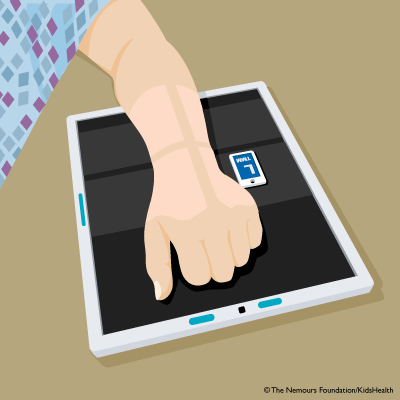 wrist_xray_illustration wrist_xray_illustration
