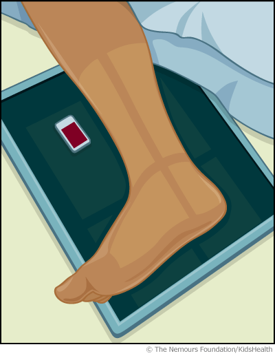 ankle_xray_illustration ankle_xray_illustration