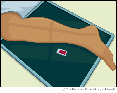 xray_illustration xray_illustration