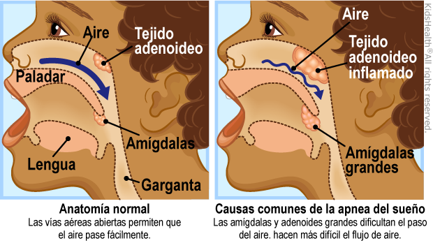 illustration illustration