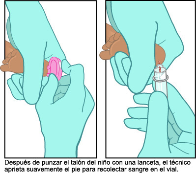análisis de sangre, talón análisis de sangre, talón