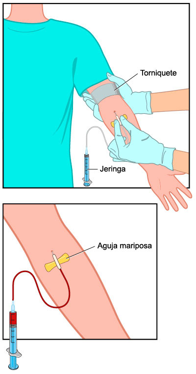 análisis de sangre análisis de sangre