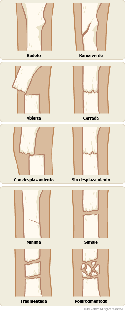 illustration illustration