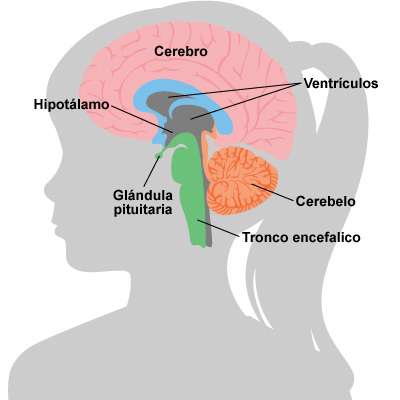 Resonancia magnetica cerebro Resonancia magnetica cerebro