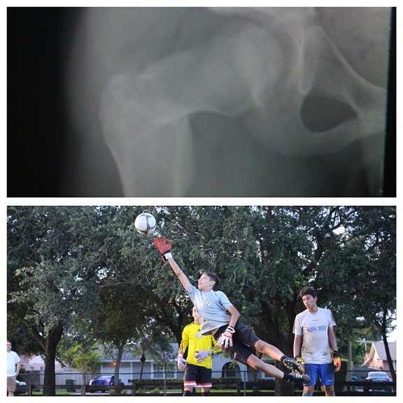 Two images in one; first is of an x-ray the lower image is of Esteban blocking a ball in the air.