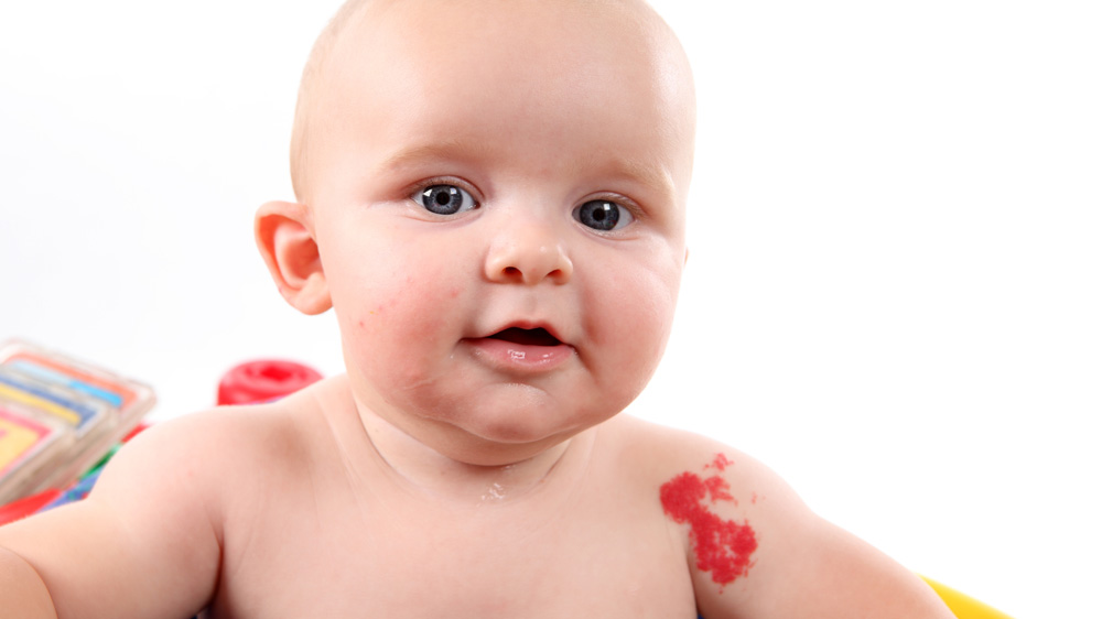 blue eyed baby with red birthmark on shoulder