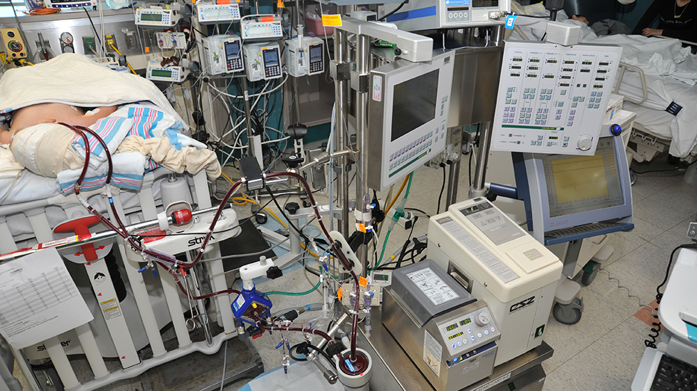 patient connected to ECMO machine