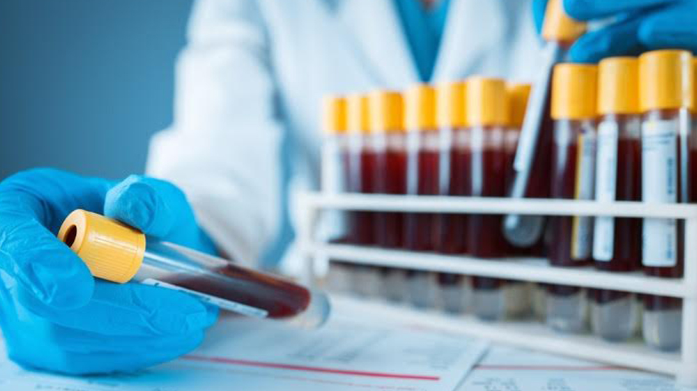 blue gloved hands comparing vials with blood samples.