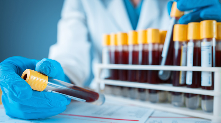 blue gloved hands comparing vials with blood samples.