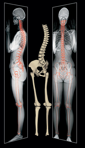 is an EOS Scan? | Children's Hospital