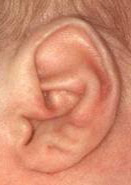 close up of ear creases on a baby