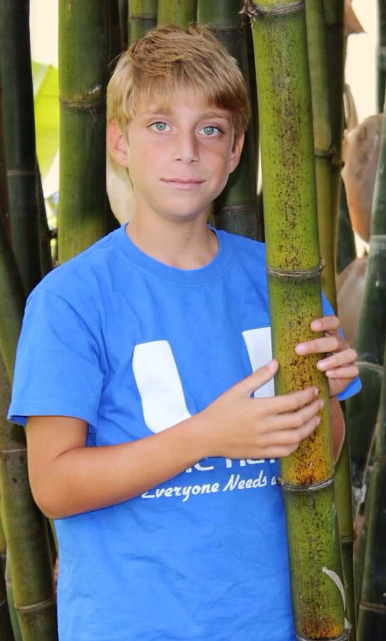 blonde blue eyed boy, around 12 years old, with BWS.