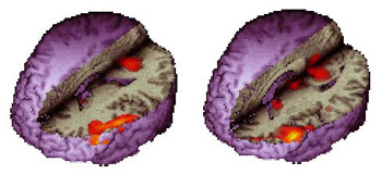 3D-surface rendering and orthogonal views.