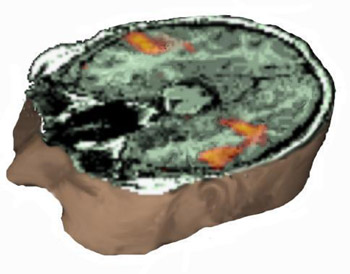 3d brain scan.