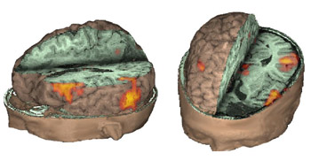 3d brain scan