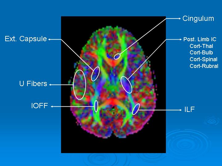 brain scan