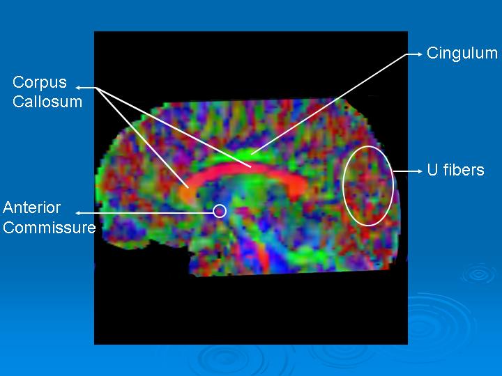 brain scan with lit up areas