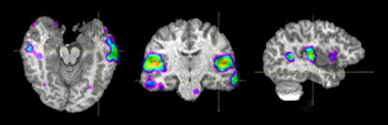 Sagittal View and Coronal view