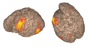 Left lateral view and Top-posterior-left angled view.