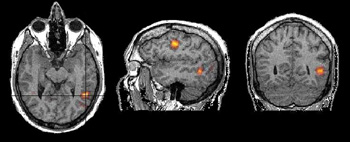 Sagittal View and Coronal view