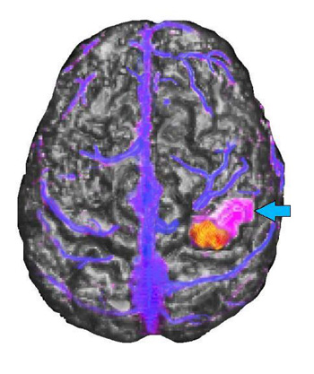 Triple Rendering mid-sagittal top view