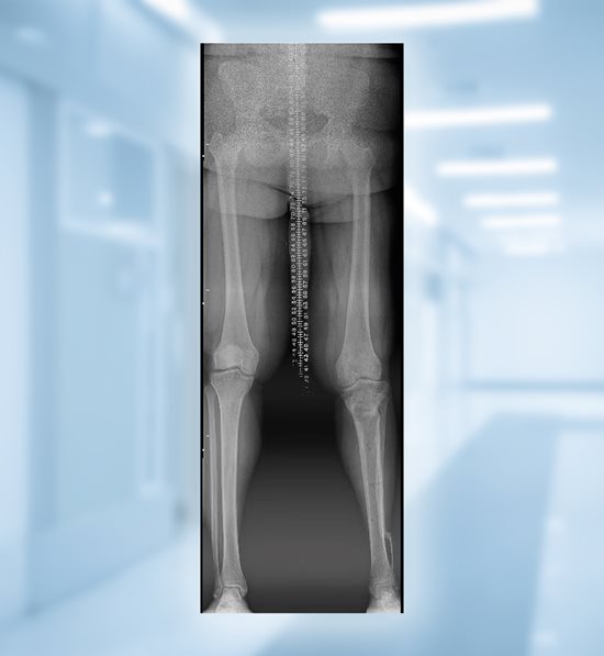 Bianca's X-ray 