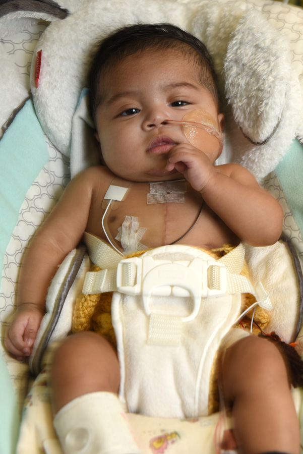Jarel in a baby seat with Surgical Sutures and breathing tube. 