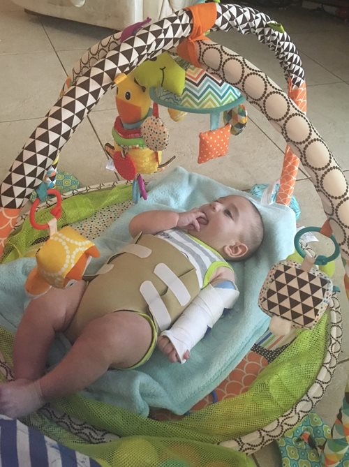 Baby Emet playing in crib wearing post surgery arm cast and torso brace