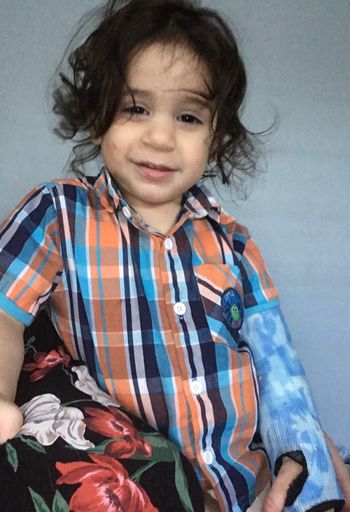 Toddler Emet wearing a cast on his arm