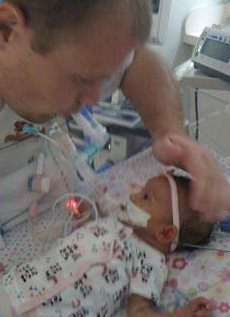 Baby Natalie while at the hospital with feeding tube. 