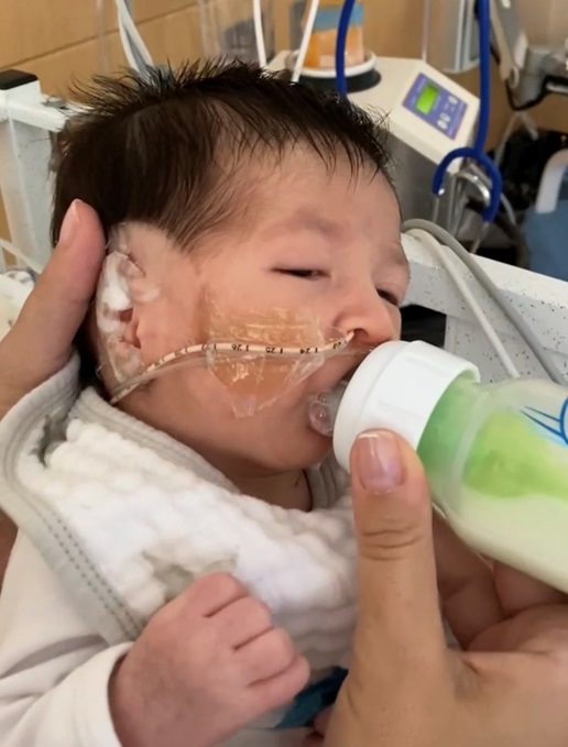 Patient Sebastian being bottle fed