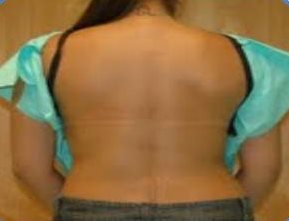Photo of Tania's back