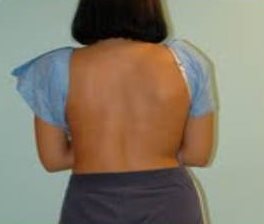 Photo of Tania's back.