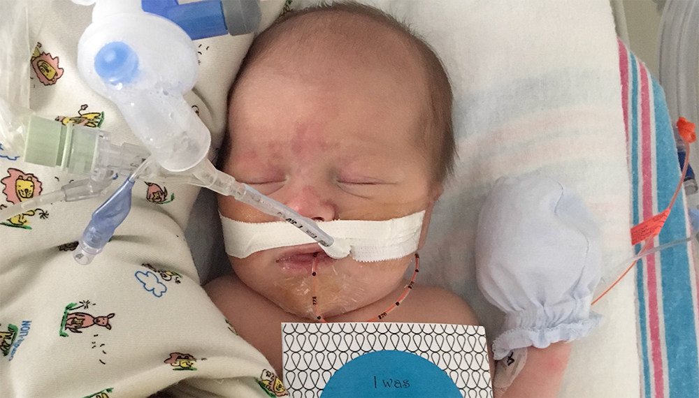 Baby Charlie, at the hospital with a feeding tube.