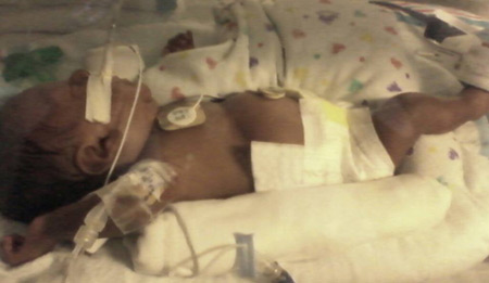 Leondre in the hospital with feeding tube