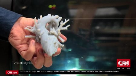 Image of a 3D printed heart