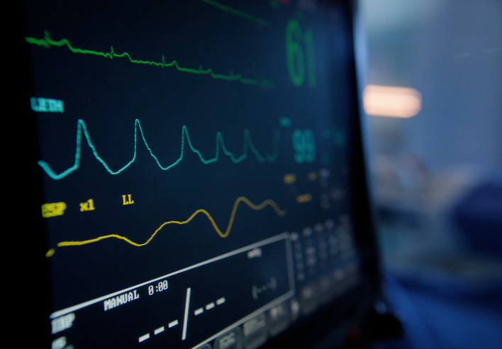 EKG monitor display.