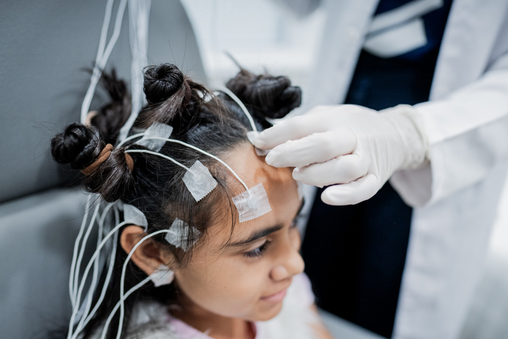 girl with electrodes on her head and hair.