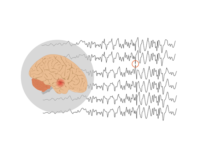 illustration of brain waves.