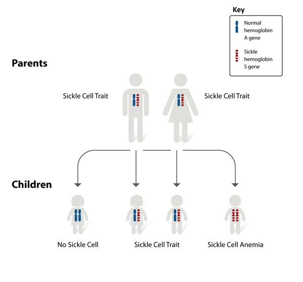How sickle cell is inherited