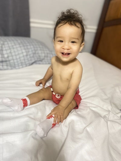 Jasiah sonríe de niño pequeño después de la cirugía