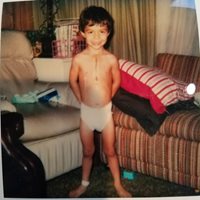 Harry as a little boy without a shirt showing his surgery chest scare.